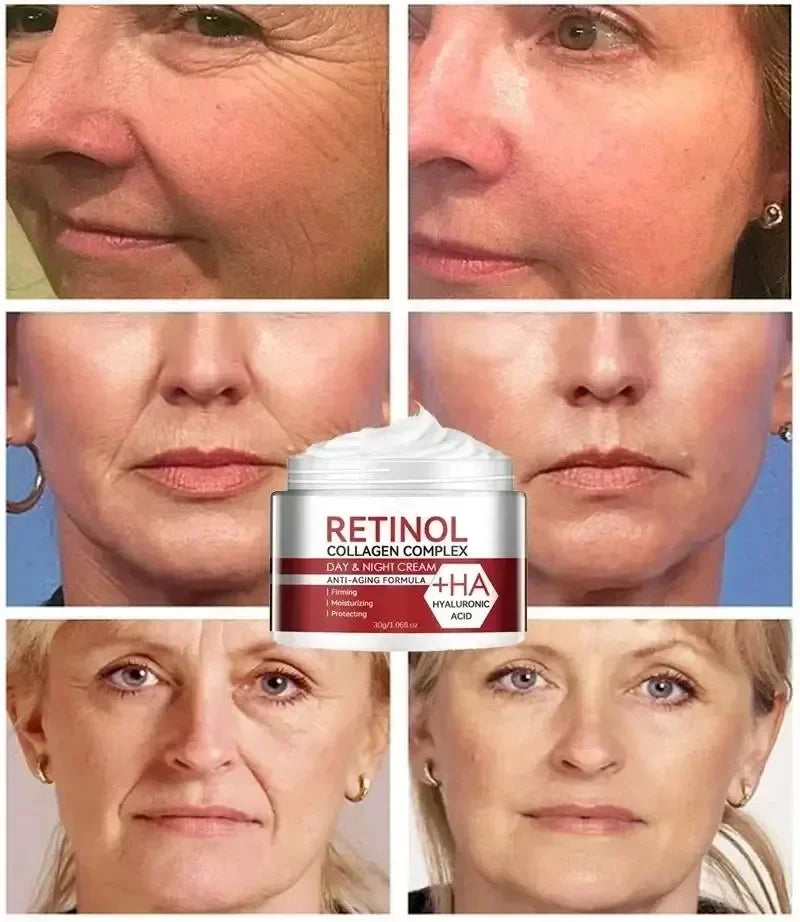 Anti Aging Face Cream for Fine Lines 2025-2